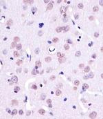 YY1 Antibody in Immunohistochemistry (Paraffin) (IHC (P))