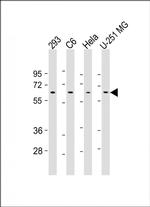 YY1 Antibody in Western Blot (WB)