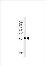 GMFG Antibody in Western Blot (WB)