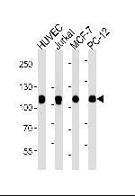 TOP1 Antibody in Western Blot (WB)