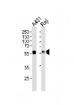 Lyn Antibody in Western Blot (WB)