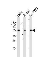 PPAR alpha Antibody in Western Blot (WB)