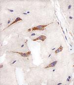 Aurora A Antibody in Immunohistochemistry (Paraffin) (IHC (P))