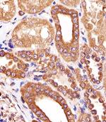 ATG3 Antibody in Immunohistochemistry (Paraffin) (IHC (P))