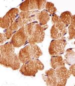 ATG3 Antibody in Immunohistochemistry (Paraffin) (IHC (P))