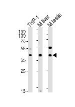 ATG3 Antibody in Western Blot (WB)