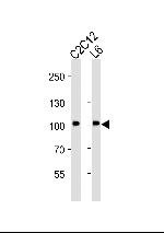 MUSK Antibody in Western Blot (WB)