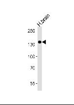 TrkC Antibody in Western Blot (WB)