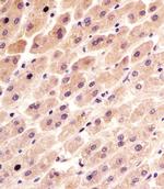 FER Antibody in Immunohistochemistry (Paraffin) (IHC (P))