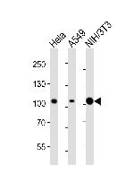 FER Antibody in Western Blot (WB)