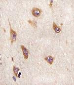 ATG4A Antibody in Immunohistochemistry (Paraffin) (IHC (P))