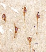 TrkB Antibody in Immunohistochemistry (Paraffin) (IHC (P))