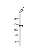 MCK10 Antibody in Western Blot (WB)