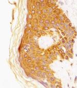 CSF1R Antibody in Immunohistochemistry (Paraffin) (IHC (P))