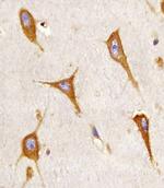 BAP31 Antibody in Immunohistochemistry (Paraffin) (IHC (P))