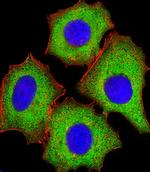 eIF4E Antibody in Immunocytochemistry (ICC/IF)