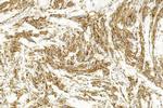 MiTF Antibody in Immunohistochemistry (Paraffin) (IHC (P))