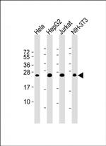 RAB5B Antibody in Western Blot (WB)