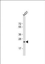 RAB5B Antibody in Western Blot (WB)