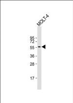 ETS1 Antibody in Western Blot (WB)