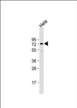 BANP Antibody in Western Blot (WB)