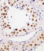 RAP1 Antibody in Immunohistochemistry (Paraffin) (IHC (P))