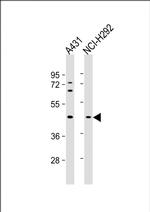 SERPINB3 Antibody in Western Blot (WB)