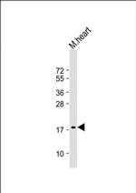 ANP Antibody in Western Blot (WB)