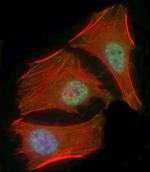 SMAD1 Antibody in Immunocytochemistry (ICC/IF)