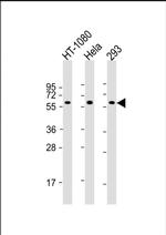 SMAD1 Antibody in Western Blot (WB)