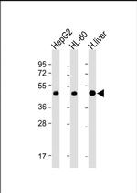 Adenosine Kinase Antibody in Western Blot (WB)