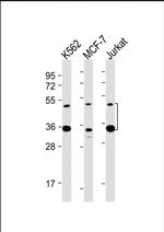 MBD2 Antibody in Western Blot (WB)