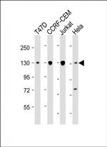 DNMT3A Antibody in Western Blot (WB)