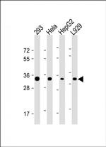 STUB1 Antibody in Western Blot (WB)