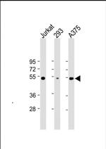 RBCK1 Antibody in Western Blot (WB)