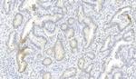 ROS1 Antibody in Immunohistochemistry (Paraffin) (IHC (P))