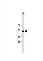 PSMC2 Antibody in Western Blot (WB)