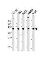 TSG101 Antibody in Western Blot (WB)