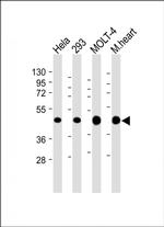 MTHFD2 Antibody in Western Blot (WB)