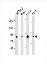 PLOD1 Antibody in Western Blot (WB)