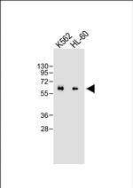 CARD9 Antibody in Western Blot (WB)