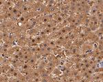 Aminoacylase Antibody in Immunohistochemistry (Paraffin) (IHC (P))