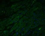 Myoglobin Antibody in Immunohistochemistry (Paraffin) (IHC (P))