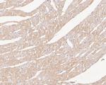 Myoglobin Antibody in Immunohistochemistry (Paraffin) (IHC (P))