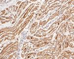 Myoglobin Antibody in Immunohistochemistry (Paraffin) (IHC (P))