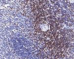 CD5 Antibody in Immunohistochemistry (Paraffin) (IHC (P))