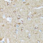 CaMKII Pan Antibody in Immunohistochemistry (Paraffin) (IHC (P))