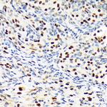 PBRM1 Antibody in Immunohistochemistry (Paraffin) (IHC (P))