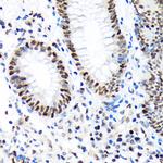 PBRM1 Antibody in Immunohistochemistry (Paraffin) (IHC (P))