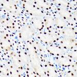 PBRM1 Antibody in Immunohistochemistry (Paraffin) (IHC (P))